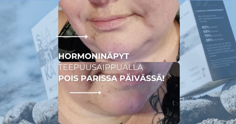 Hormoninäpyt teepuusaippualla pois parissa päivässä!