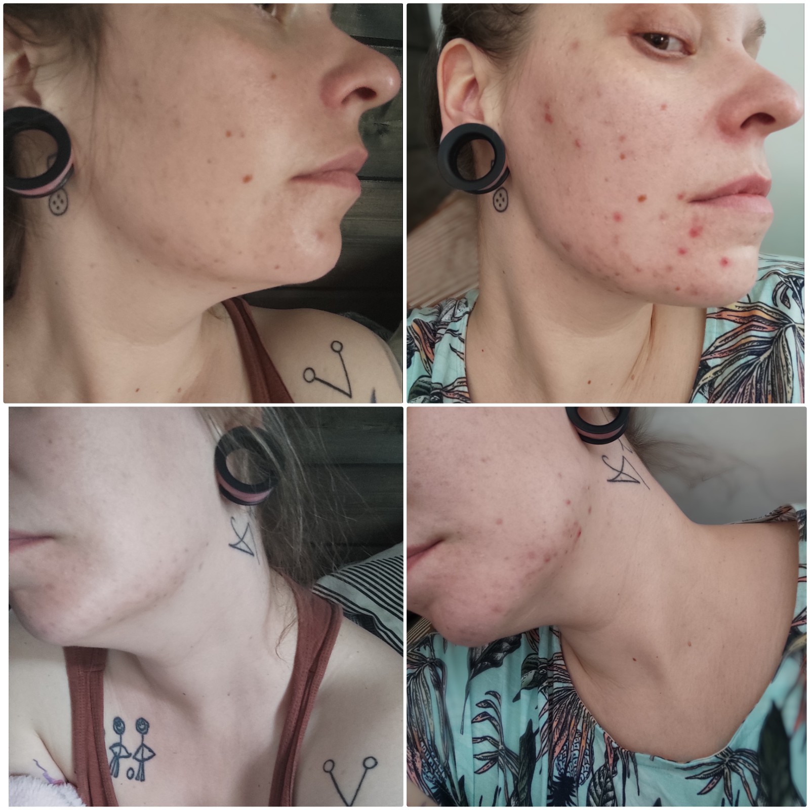 Teepuusaippua auttoi parissa kuukaudessa rauhoittamaan maskin käytöstä ja stressistä kärsineen ihon. Muuhun en enää vaihda.