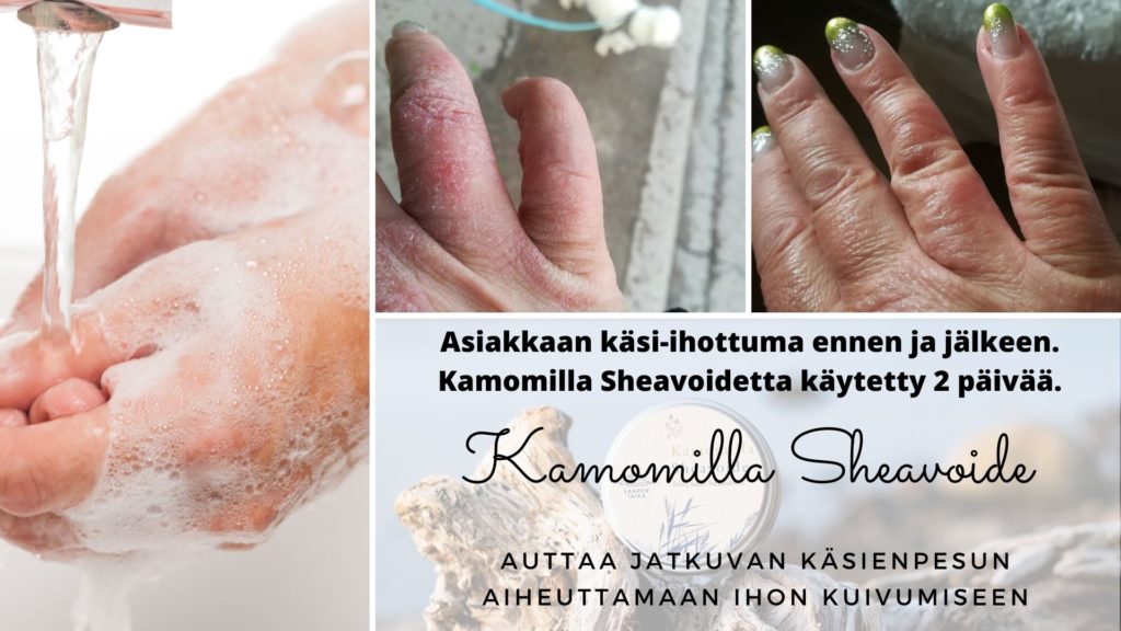 Kuiviin käsiin helpotusta Saaren Taika Kamomilla sheavoiteella