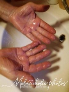 Autonkorjaajan Rasvanäpin saippualla puhtaaksi pestyt kädet kämmenpuolelta