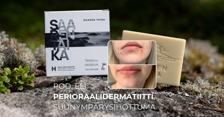POD, eli Perioraalidermatiitti, suunympärysihottuma