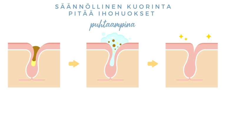 Säännöllinen kuorinta pitää ihohuokset puhtaampina