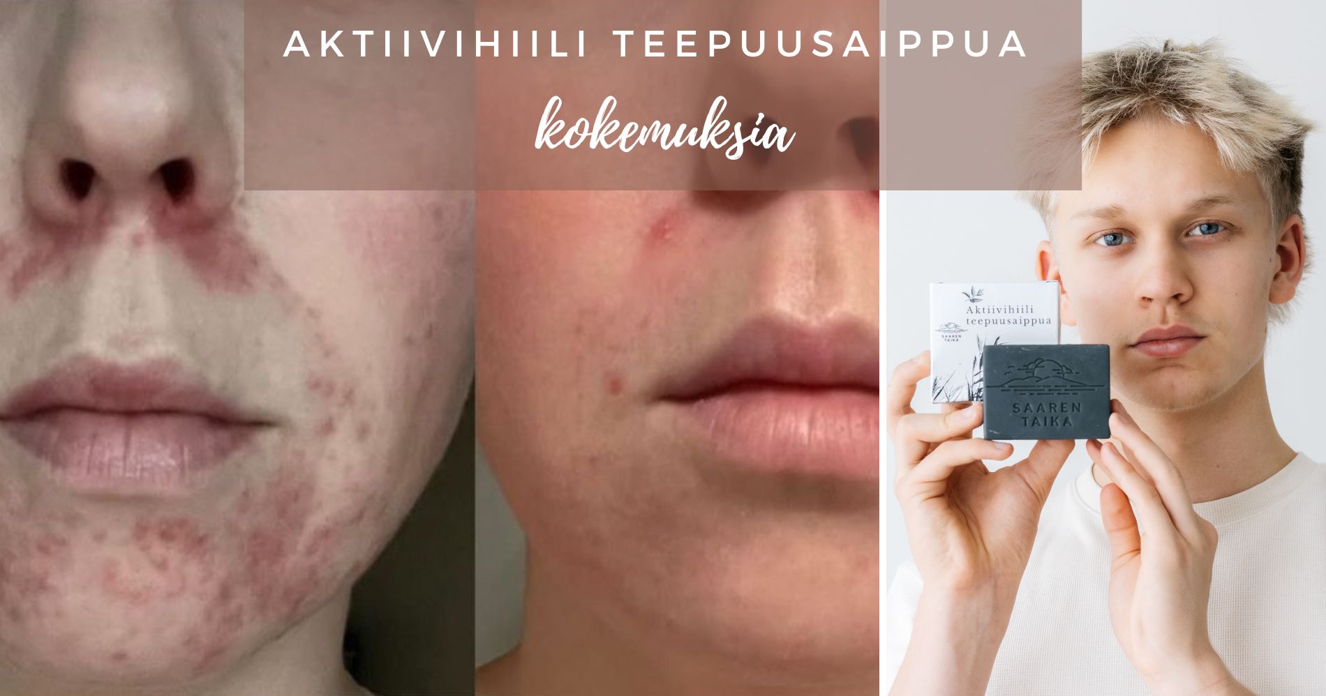 Saaren Taika Aktiivihiili Teepuusaippua kokemuksia
