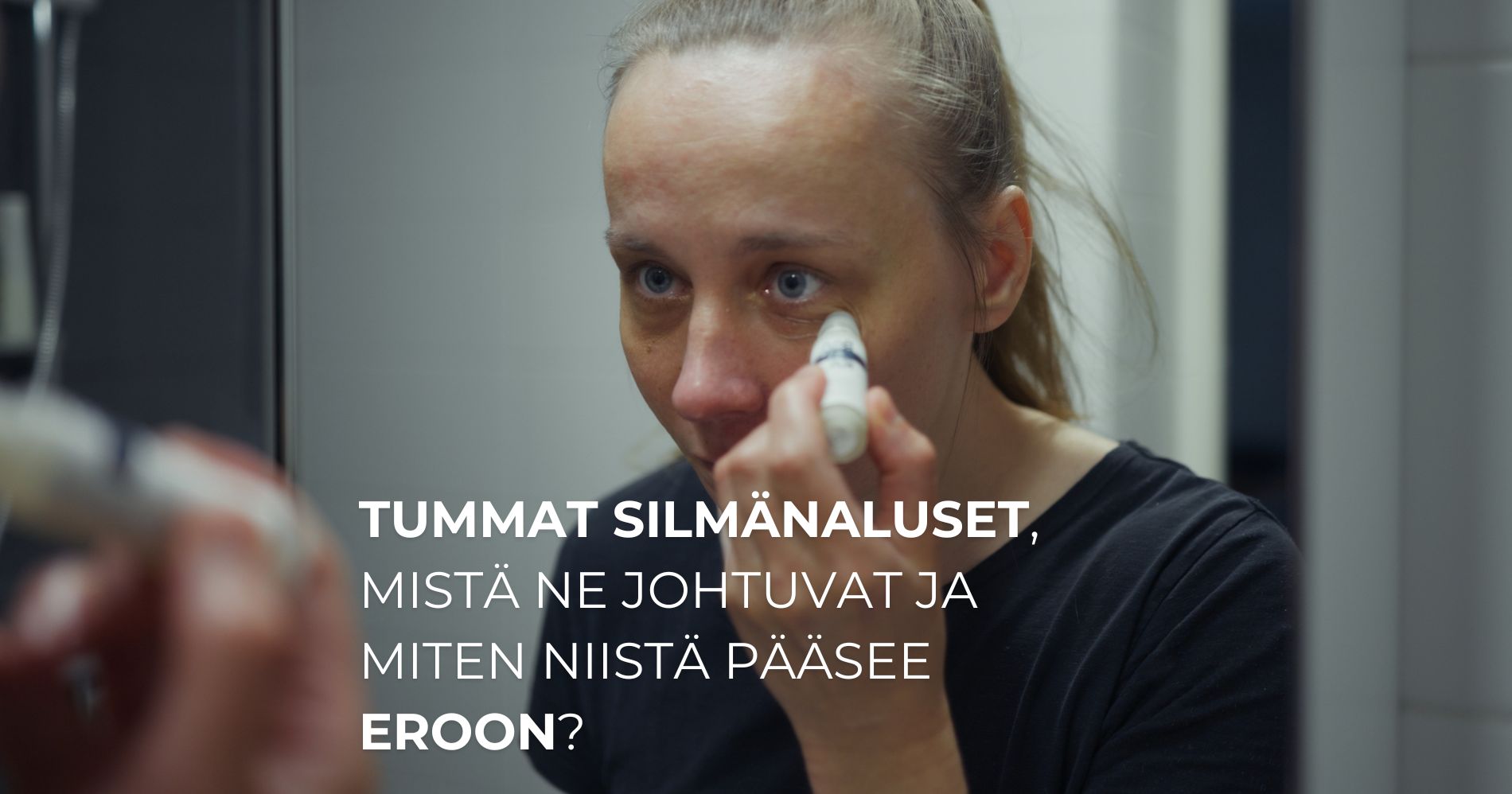 Tummat silmänaluset, mistä ne johtuvat ja miten niistä pääsee eroon