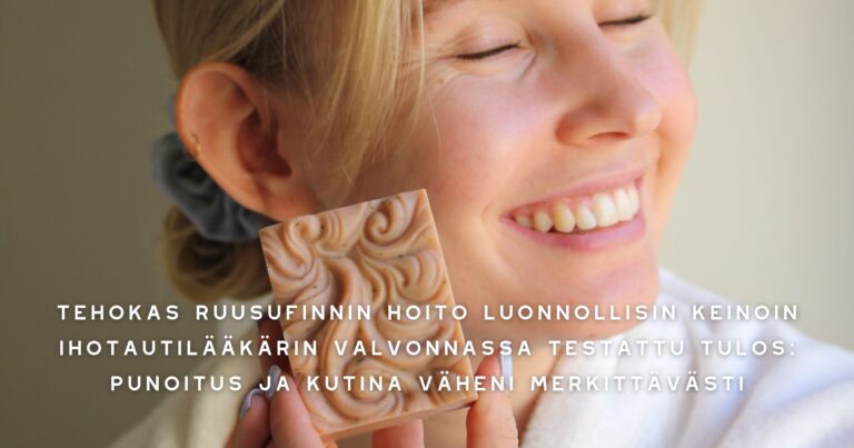 Tehokas Ruusufinnin Hoito Luonnollisin Keinoin ihotautilääkärin valvonnassa testattu tulos punoitus ja kutina väheni merkittävästi