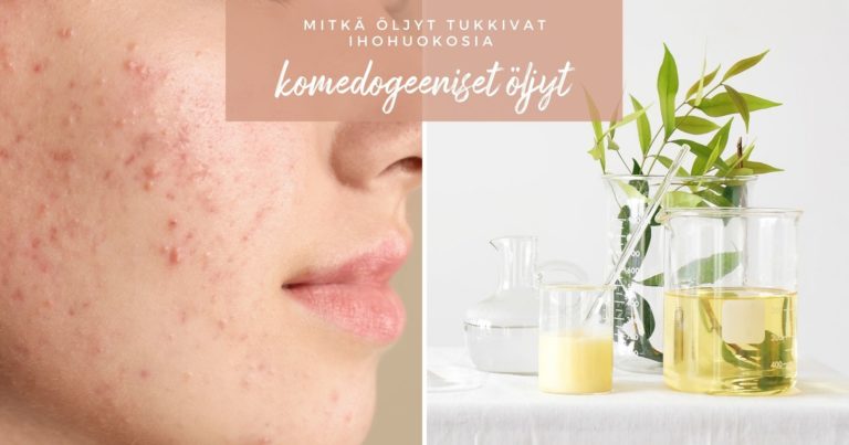 Mitkä öljyt tukkivat ihohuokosia, eli komedogeeniset öljyt