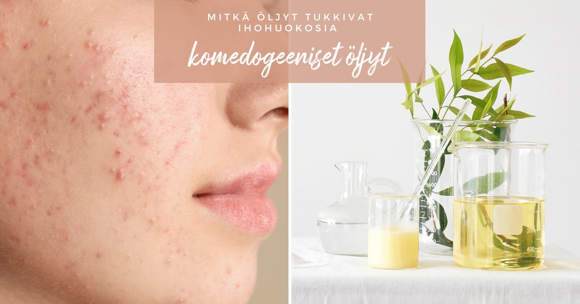 Mitkä öljyt tukkivat ihohuokosia, eli komedogeeniset öljyt