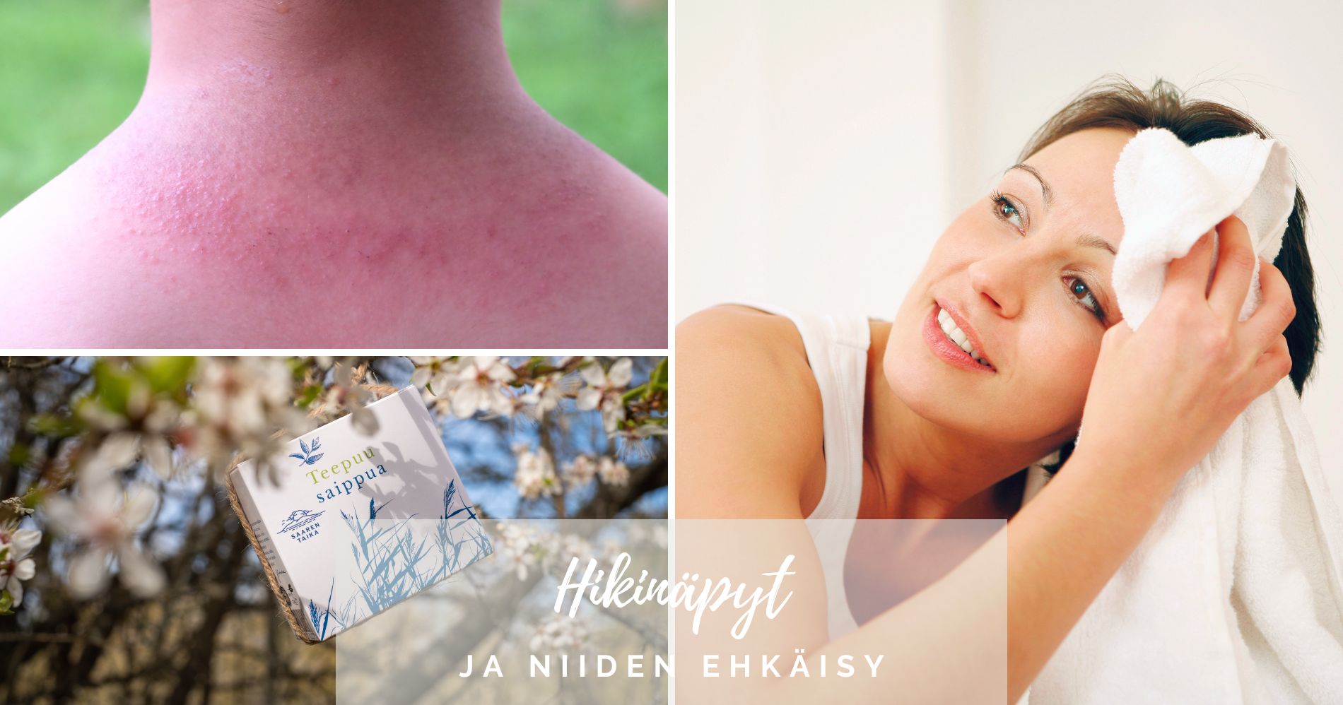 Näin ehkäiset hikinäppyjä, hikinäpyt ja niiden ehkäisy