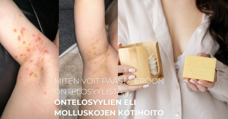 Miten voit päästä eroon ontelosyylistä, katso ontelosyylien eli molluskojen kotihoito