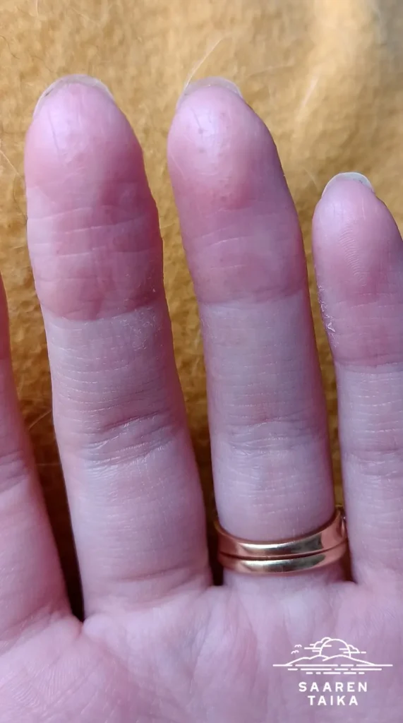 Iho oireet parantuneet! Minulla on epäilty jotain ihosairautta kun sormieni päihin tulee taukoamatta pieniä nesterakkuloita, sekä kamala kutina ja ihon kuivuminen verille. Mikään rasva ei ole auttanut. (Kokeillut erilaisia resepti, sekä ei reseptirasvoja). Äitini vinkistä ja ehkä hieman painostuksestakin päätin ostaa ja testata tätä kamomilla sheavoide rasvaa ja täytyy myöntää näin toivonsa menettäneenä, että tämä oikeasti auttaa. Näin parin viikon käytön jälkeen nesterakkuloita ei ole enää tullut, sekä iho rupeaa paranemaan. Suoraan sanottuna tämä on auttanut paljon paremmin kuin vahva kortisonivoide. Plussaa myös että tuoksuu todella hyvältä. Myös mieheni jolla on atooppinen ihottuma, kehui tätä.