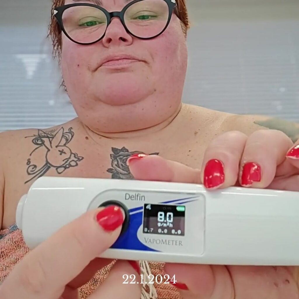 Transepidermal water loss (TEWL) mittaus, kun on käytetty Saaren Taika palasaippuaa kasvoilla 7 vuoden ajan, ihon suojamuuri on hyvässä kunnossa