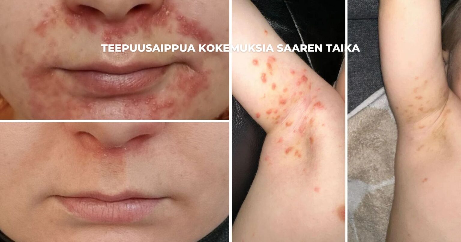Joulukalenteri 2025 Saaren Taika Haastavalle Iholle Joulukalenteri 2025 Saaren Taika Haastavalle Iholle