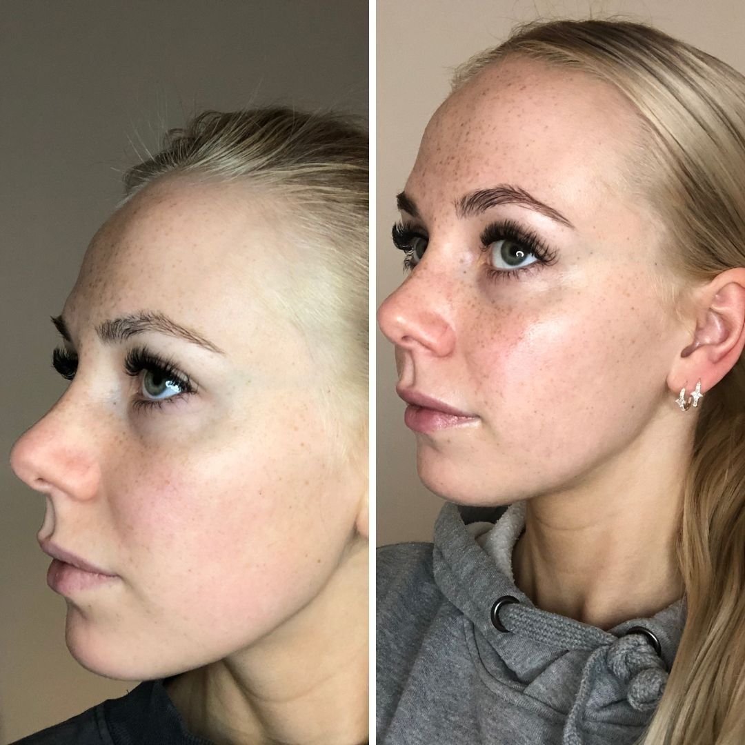 Olen saanut tuotteilla hehkua kasvoilleni, eikä ihoni näytä niin harmaalta ja kuivalta enää.