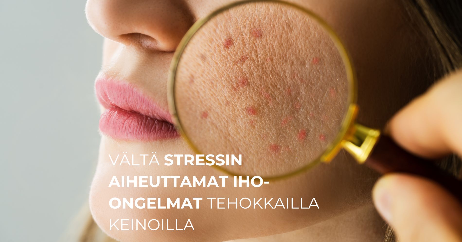 Vältä stressin aiheuttamat iho-ongelmat tehokkailla keinoilla