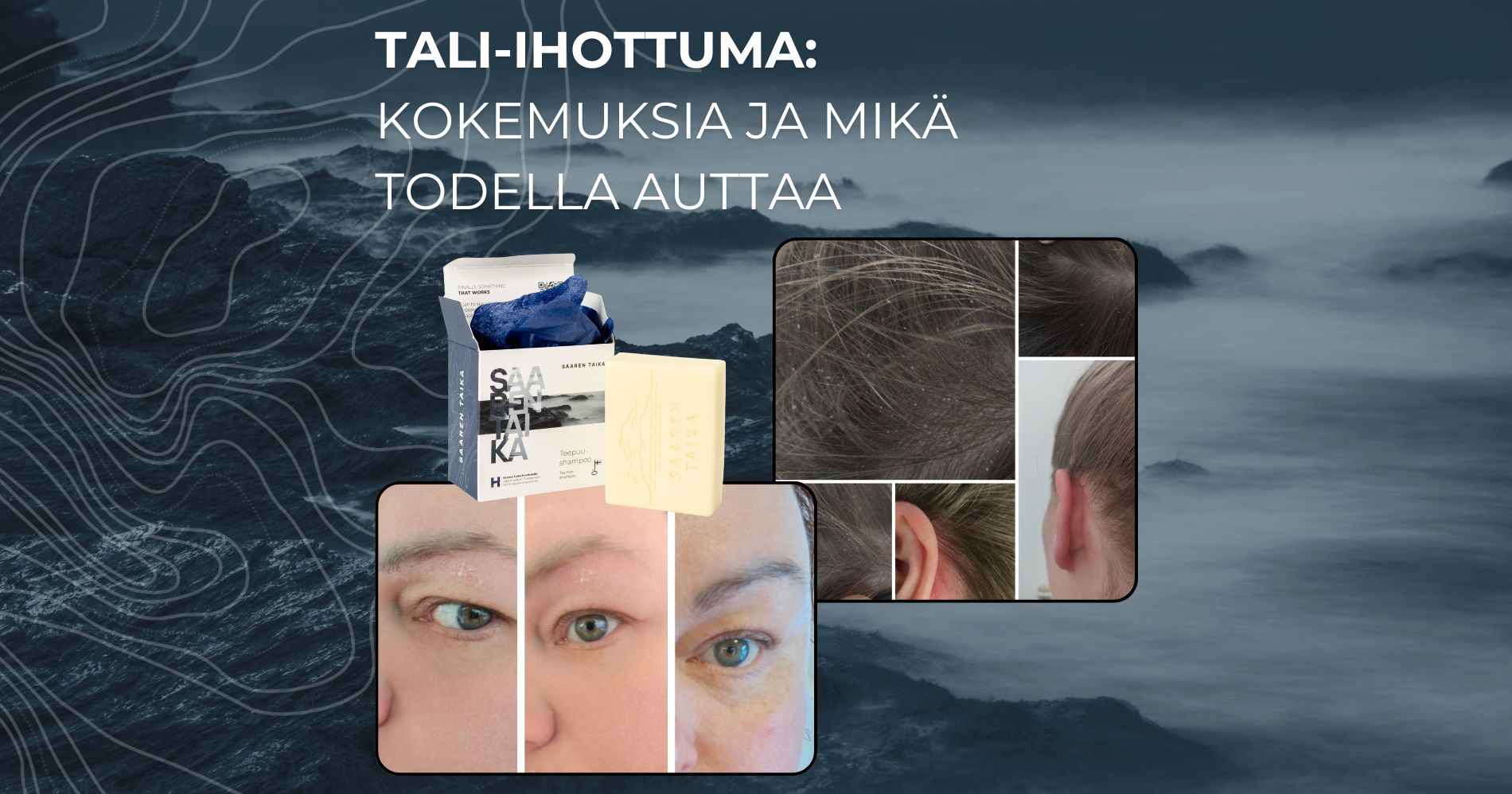 Tali-ihottuma Kokemuksia ja mikä todella auttaa