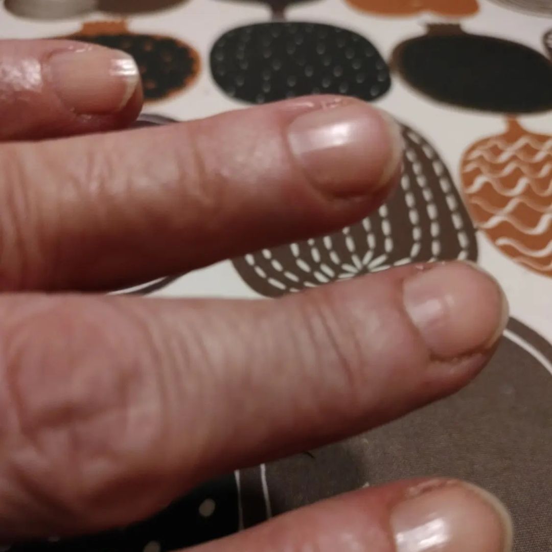 Hyviä kokemuksia Kamomilla - Sheavoiiteesta Minulla on herkkä ja kuiva iho (40-vuoden ikään asti hankala ruoka-aineallergia ihottumineen) ja tilasin Kamomilla-Sheavoidetta, jota kokeilin ensimmäiseksi kipeiin ja kynsinauhojen kuivumiseen ja repeilyyn ja ilokseni siveltyäni noin viikon ajan voidetta kynsinauhoihin, ovat ne eheytyneet.. Voide sulaa hetkessä ihon lämmöstä ja imeytyy hyvin. Anne 69 v.