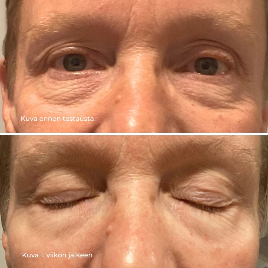 Saaren Taika Natural Ruusuvesi kokemuksia