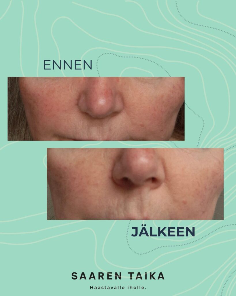 Saaren Taika Natural -tuotteiden palautteet