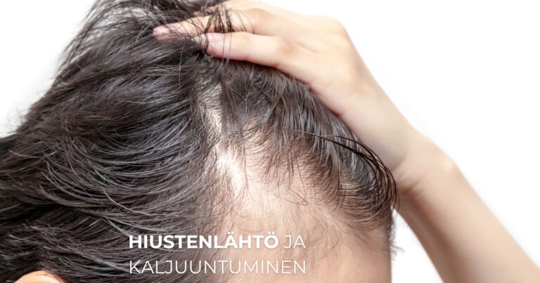 Hiustenlähtö ja kaljuuntuminen