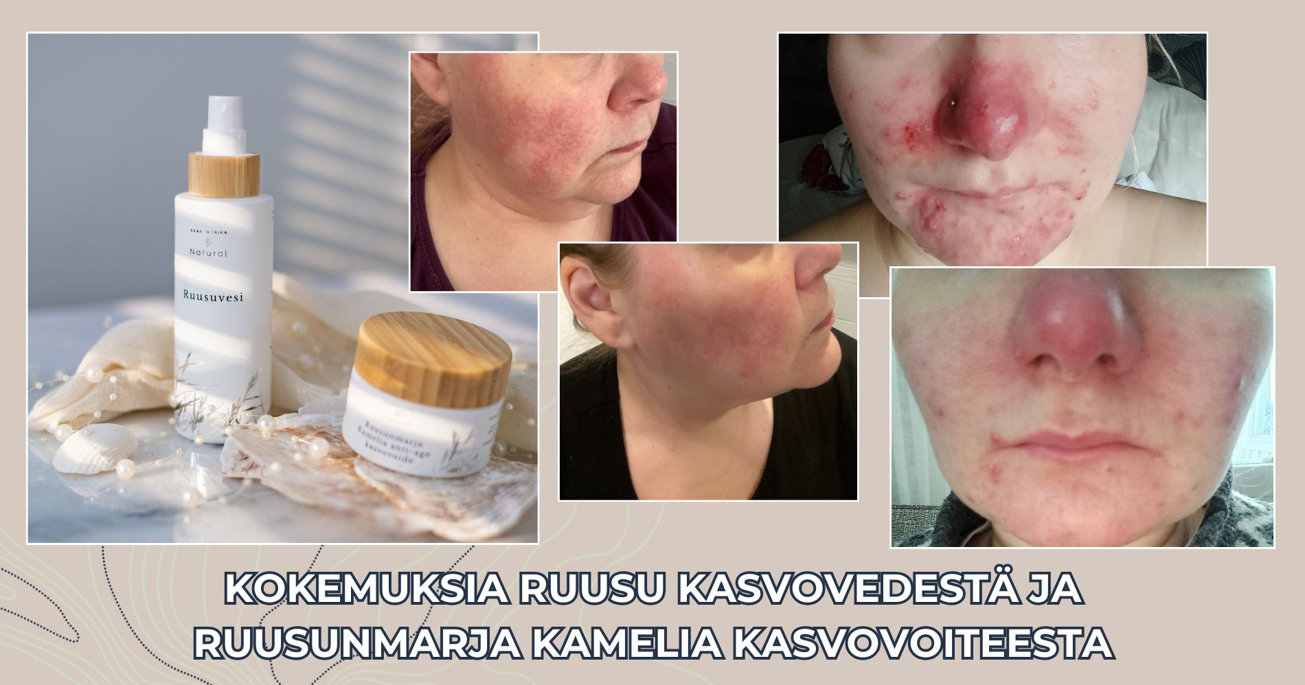 Kokemuksia Ruusu kasvovedestä ja Ruusunmarja Kamelia kasvovoiteesta Saaren Taika