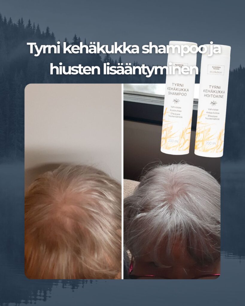 Kuvapalaute: Nyt olen käyttänyt Tyrni kehäkukka shampoota ja hoitoainetta reilut 2 kuukautta. Hiuksiin on palautunut upea kiilto ja hiukset pysyvät pidemmän aikaa rasvoittumatta. Myös hiustenlähtö lähes loppunut sekä hiukset näyttävät vahvistuneet. Olen erittäin tyytyväinen tuotteisiin.