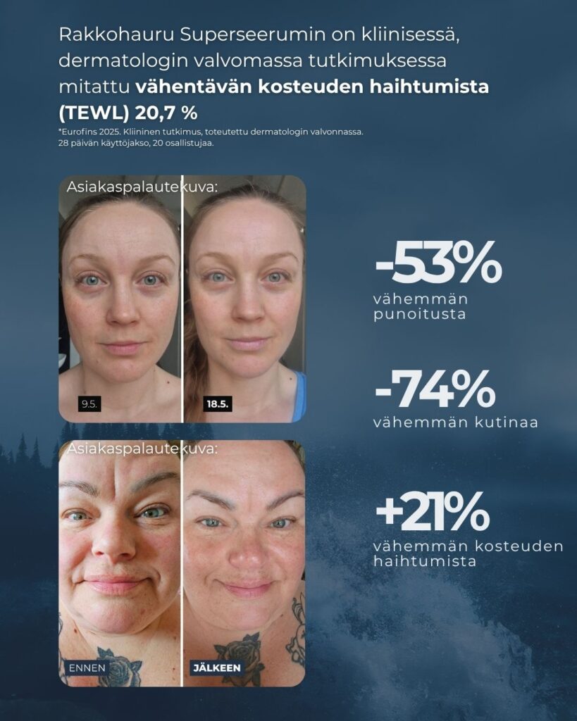Rakkohauru Superseerumin on kliinisessä, dermatologin valvomassa tutkimuksessa mitattu vähentävän kosteuden haihtumista (TEWL) 20,7 %