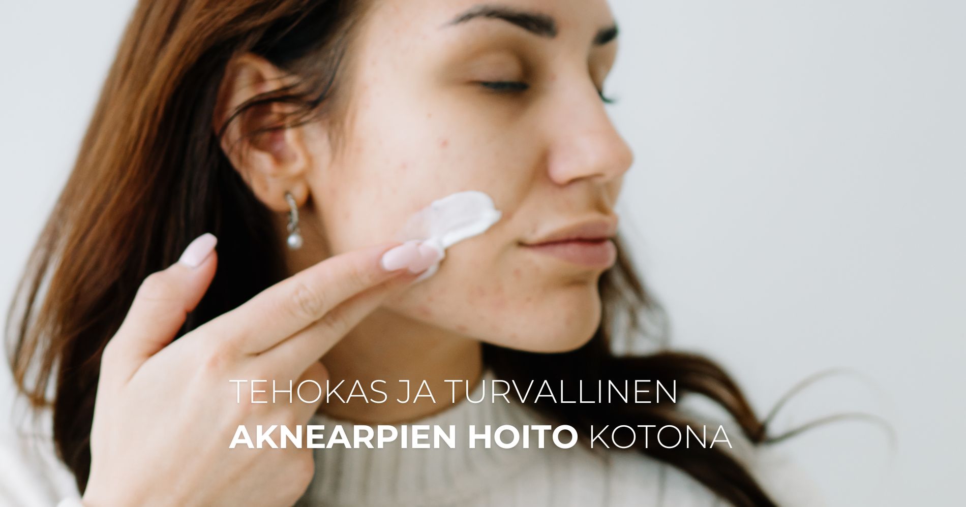 Nainen levittää kasvoseerumia aknearville hoitaakseen ihoaan luonnollisesti kotona.