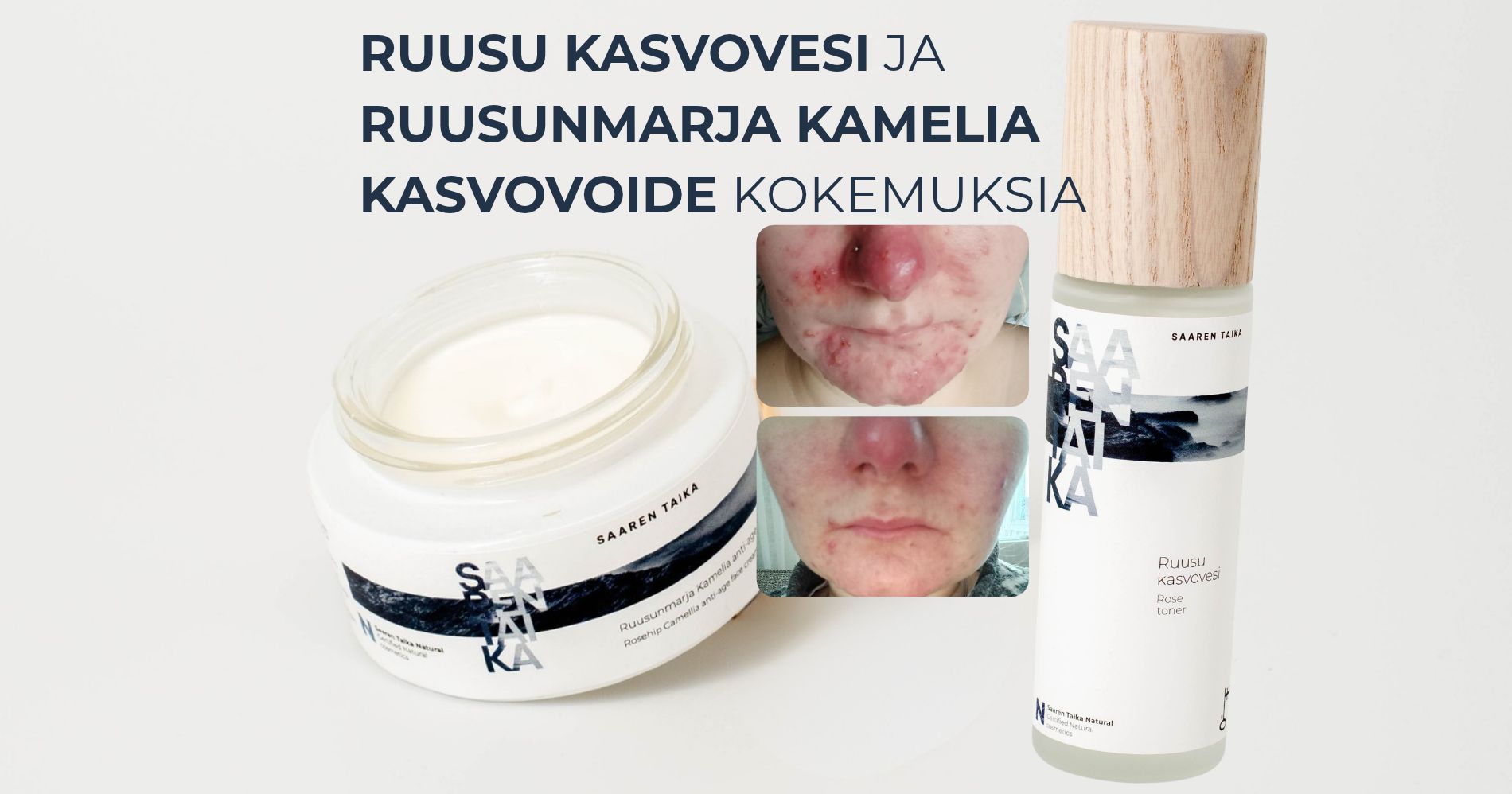 Kokemuksia Ruusu kasvovedestä ja Ruusunmarja Kamelia kasvovoiteesta
