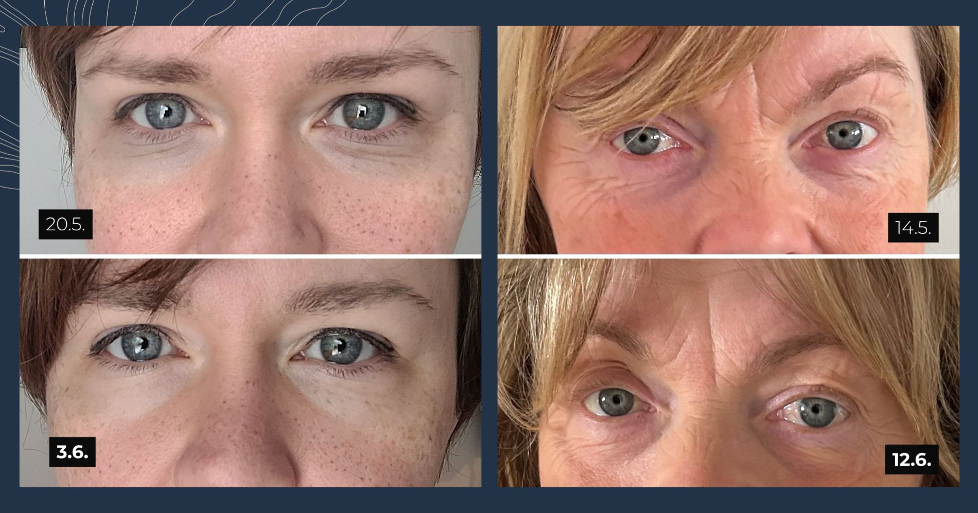 Rakkohauru Kaktusöljy Silmänympärysvoide Roll-on kokemuksia ja tuotekehitys