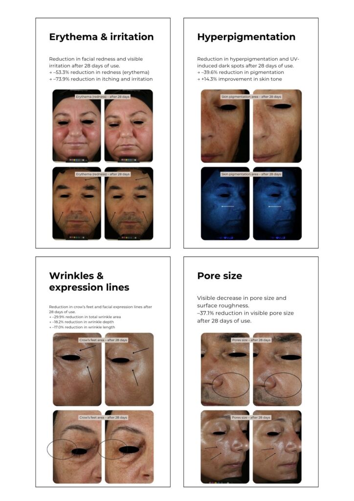 Bladderwrack Super Serum clinical study under dermatological supervision