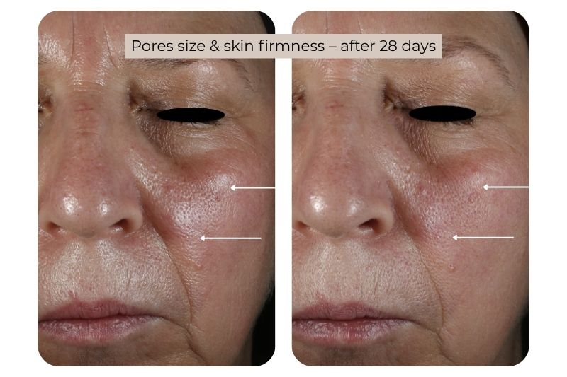 Clinical study super serum Pores size & skin firmness