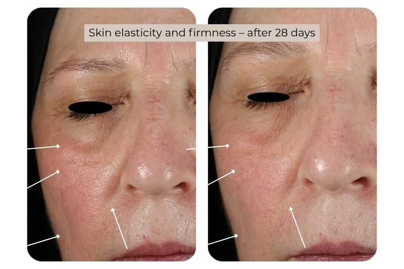 Clinical study super serum Skin elasticity and firmness