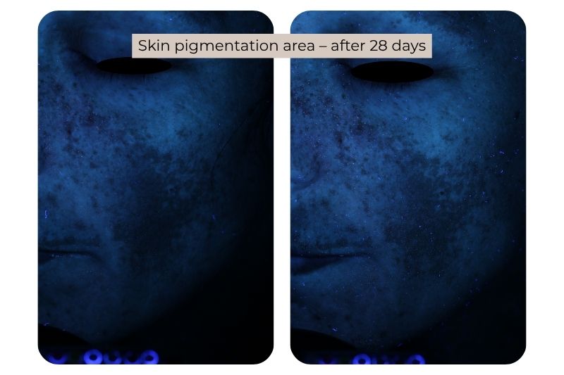Clinical study super serum Skin pigmentation area