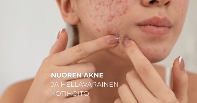 Nuoren akne ja hellävarainen kotihoito