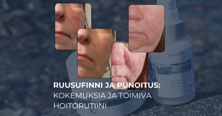 Ruusufinni ja punoitus kokemuksia ja toimiva hoitorutiini
