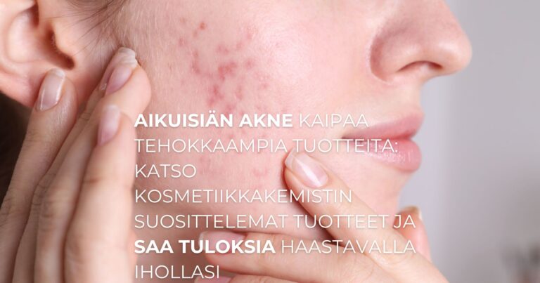 aikuisiän akne kaipaa tehokkaampia tuotteita: katso kosmetiikkakemistin suosittelemat tuotteet ja saa tuloksia haastavalla ihollasi