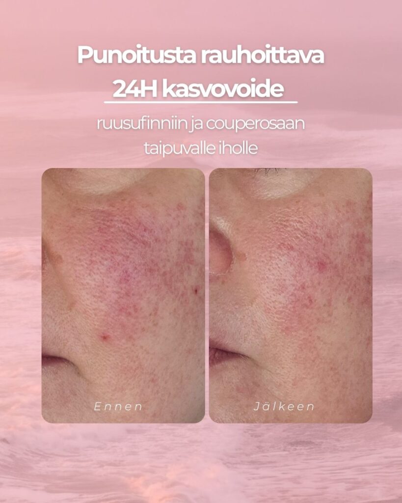 Punoitusta rauhoittava 24H kasvovoide ruusufinniin ja couperosaan taipuvalle iholle