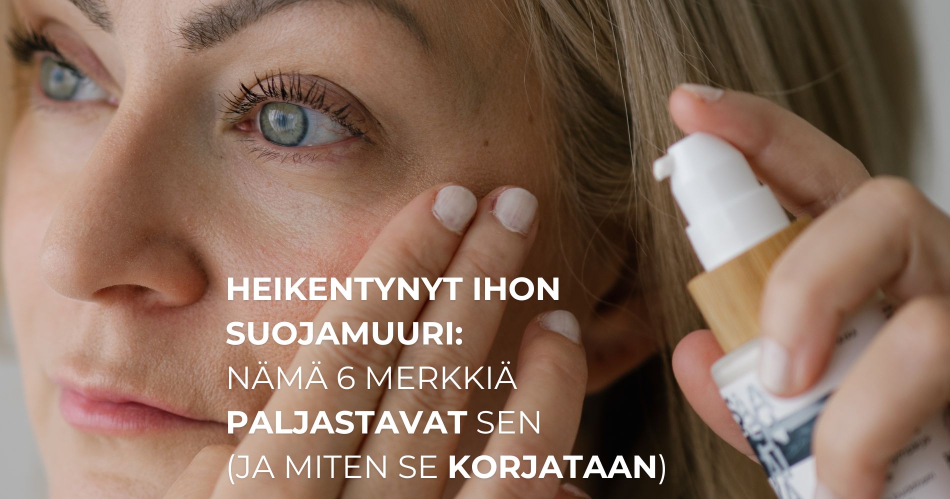 Heikentynyt ihon suojamuuri: nämä 6 merkkiä paljastavat sen (ja miten se korjataan)