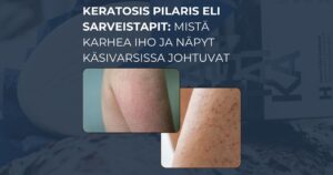 Keratosis pilaris eli sarveistapit mistä karhea iho ja näpyt käsivarsissa johtuvat