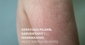 Keratosis pilaris, sarveistapit eli mansikkaiho Mistä johtuu ja hoito