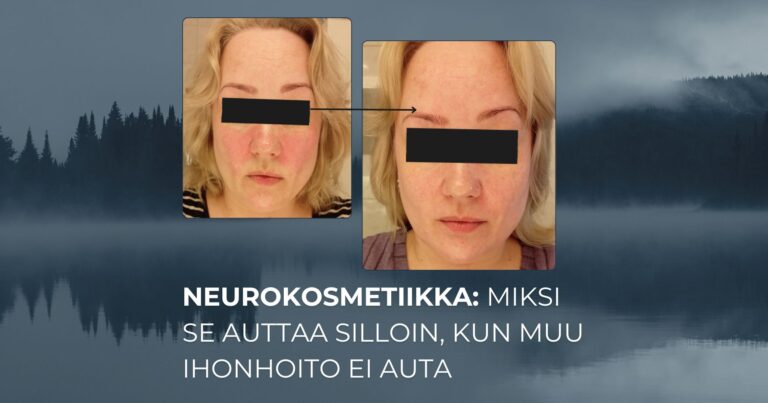 Neurokosmetiikka miksi se auttaa silloin, kun muu ihonhoito ei auta