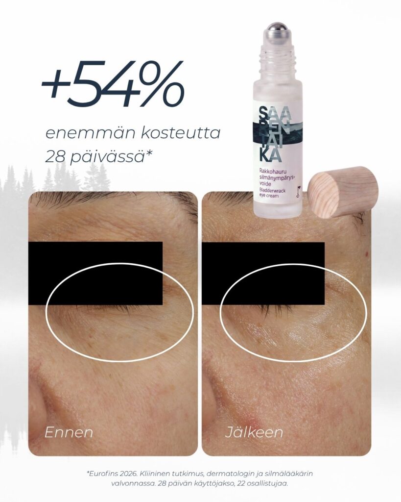 Rakkohauru silmänympärysvoiteen kliinisen tutkimuksen tulokset kosteutus