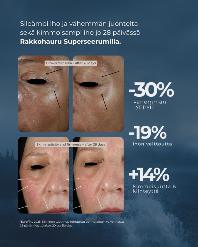 Sileämpi iho ja vähemmän juonteita sekä kimmoisampi iho jo 28 päivässä Rakkohauru Superseerumilla.