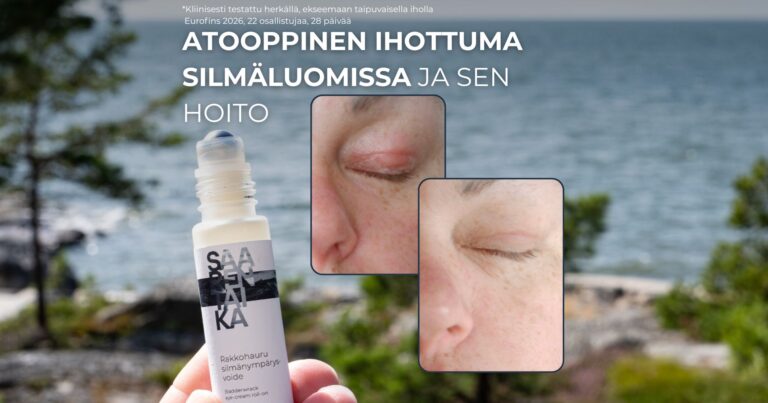 Atooppinen ihottuma silmäluomissa ja sen hoito