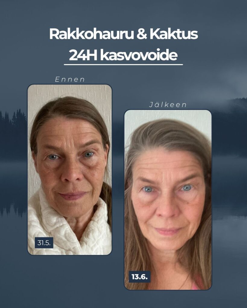 Maksaläiskien hoitoon sopiva kasvovoide on Saaren Taian Rakkohauru & Kaktus 24H prebioottinen kasvovoide.