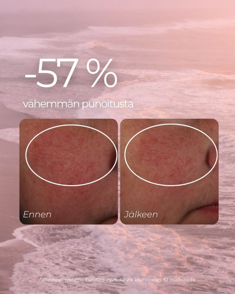 Punoitusta rauhoittava suojamuuria vahvistava seerumi on kliinisesti testattu ja se vähensi punoitusta 57 %.