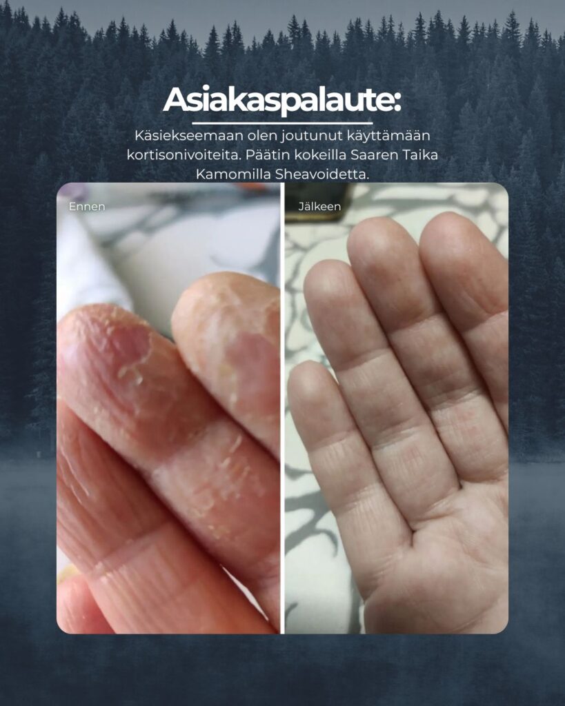 Asiakaspalaute: Kamomilla Sheavoide Mahtava tuote. Käsiekseemaan olen joutunut käyttämään kortisonivoiteita. Päätin kokeilla Saaren Taika Kamomilla Sheavoidetta. Alussa käytin useamman kerran päivässä nyt rasvaan yöksi ja käsien iho on pysynyt hyvänä. Suosittelen. Tuote on riittoisa.